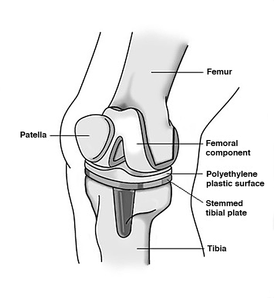 knee3.jpg