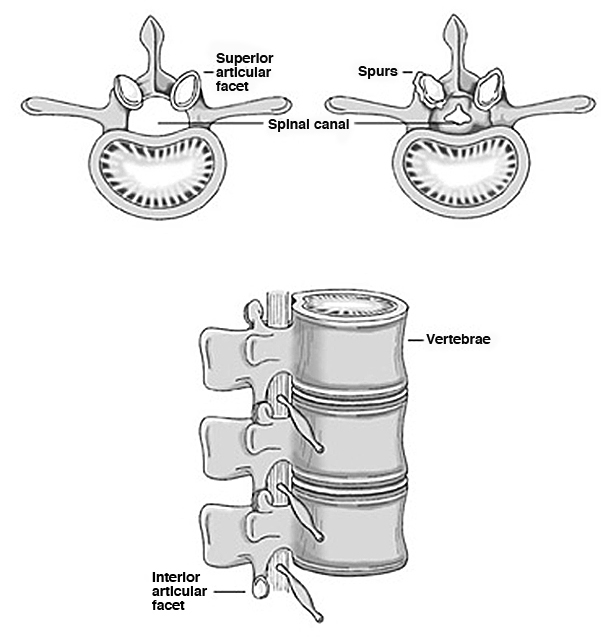 spine.jpg